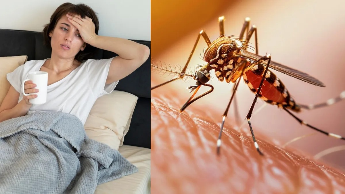 Dengue Symptoms 17 09 2024 17265