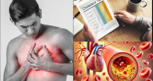 High Cholesterol Causes 24 10 20